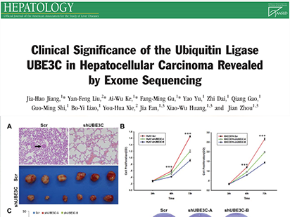 Jiang J, et al. Clinical Significance of the Ubiquitin Ligase UBE3C in Hepatocellular Carcinoma Revealed by Exome Sequencing. Hepatology.?2014 Jun;59(6):2216-27. (IF=12.003)